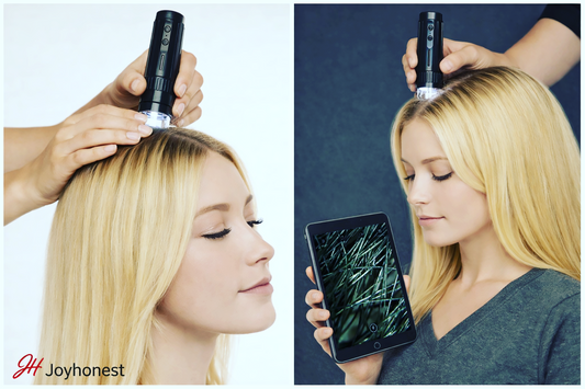 WiFi digital microscope for scalp analysis