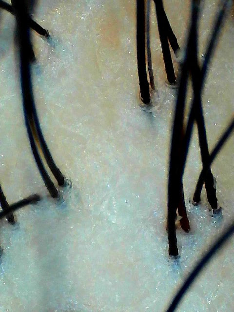 Captured by Joyhonest WiFi Scalp  Microscope