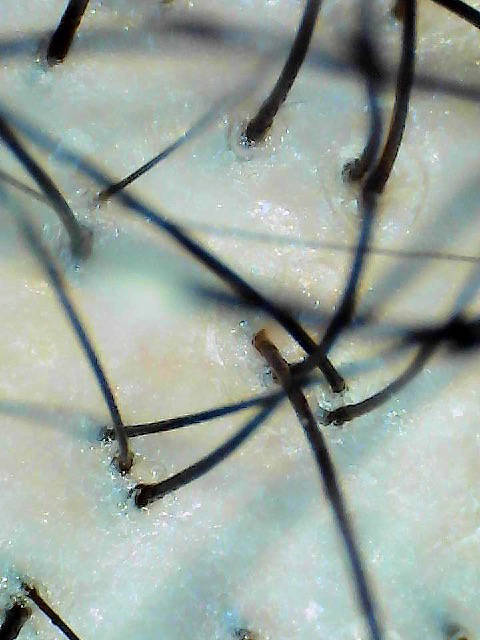 Pore inspection sample